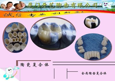 厦门牙艺陶齿-原永达