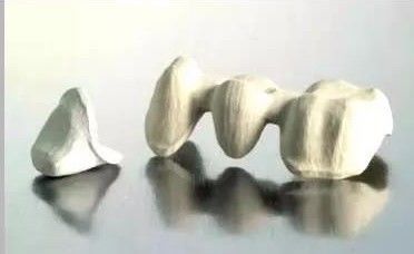 口腔常用全瓷技术详解
